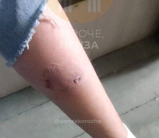 Атака бродячих собак в Пензе