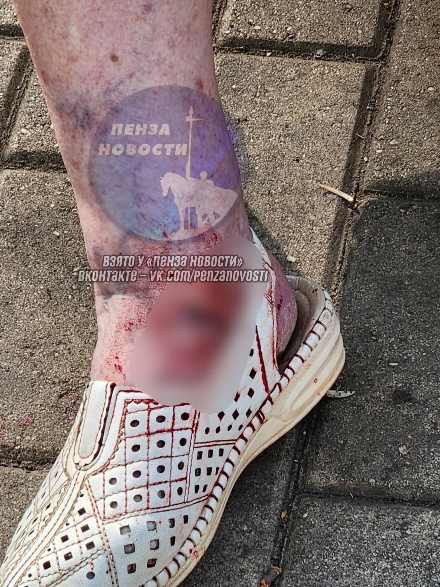 Собака напала на пенсионерку в Арбеково