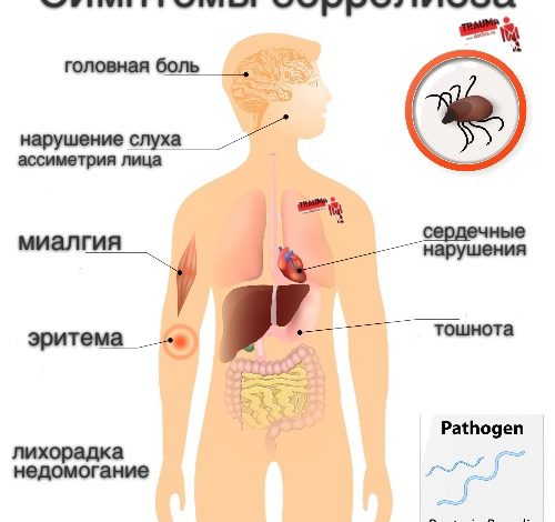 Случаи укусов клещами в Пензе превысили 400