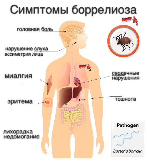 Случаи укусов клещами в Пензе превысили 400